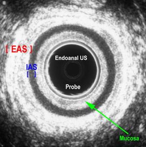 endoanal US